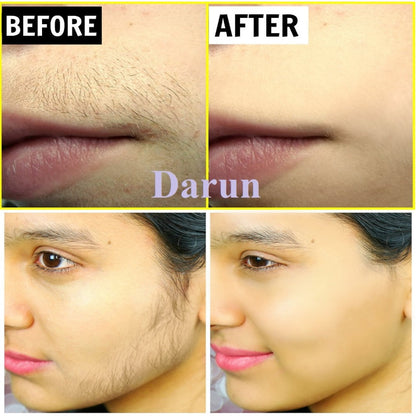 Flawless hair removal machine